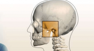 Çene eklemi rahatsızlığına dikkat !
