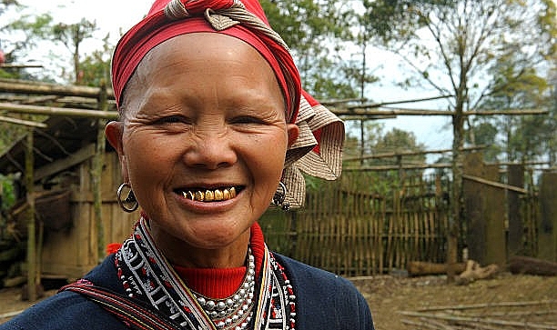 Gözlük Kusturur Mu?